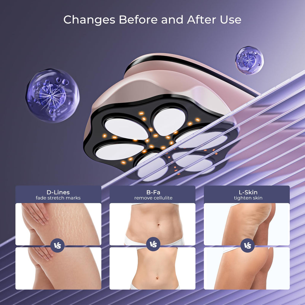 Electric Body Sculpting & Cellulite Massager with Heating