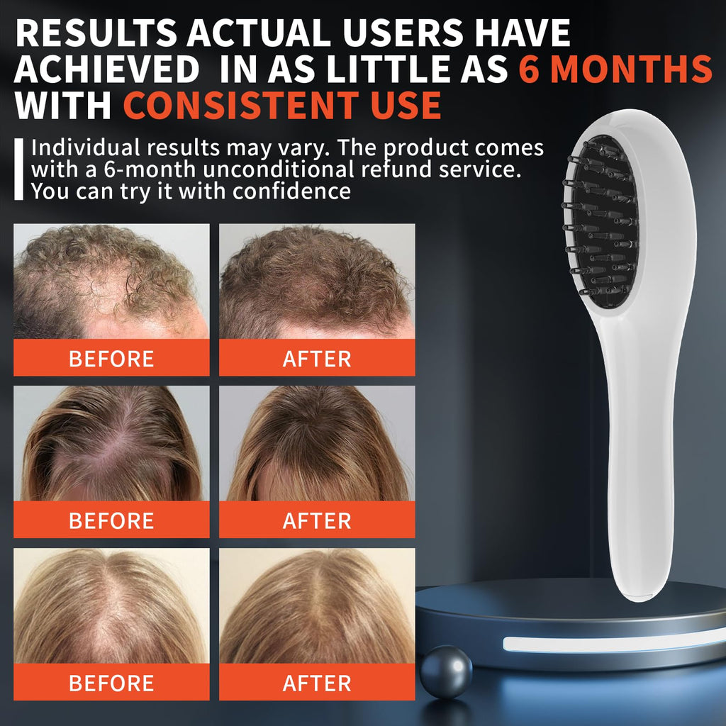 Red Light Therapy Laser Scalp Comb for Men & Women