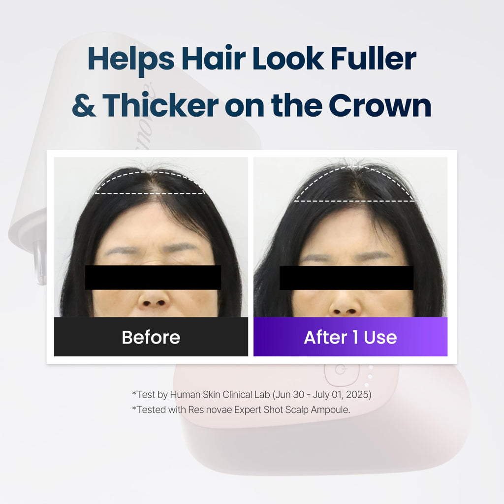 Scalp Care Device for Massage & Serum Absorption