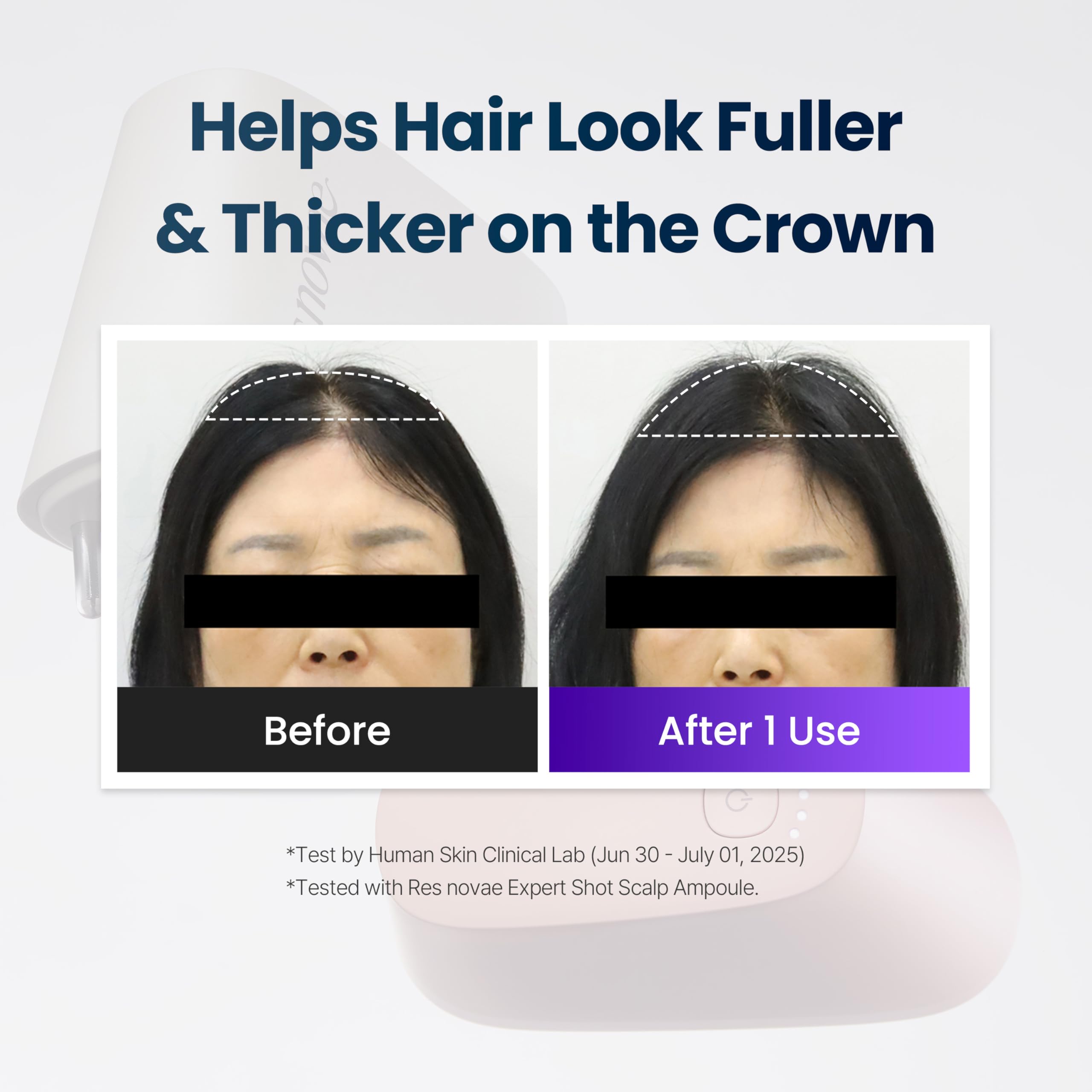 Scalp Care Device for Massage & Serum Absorption