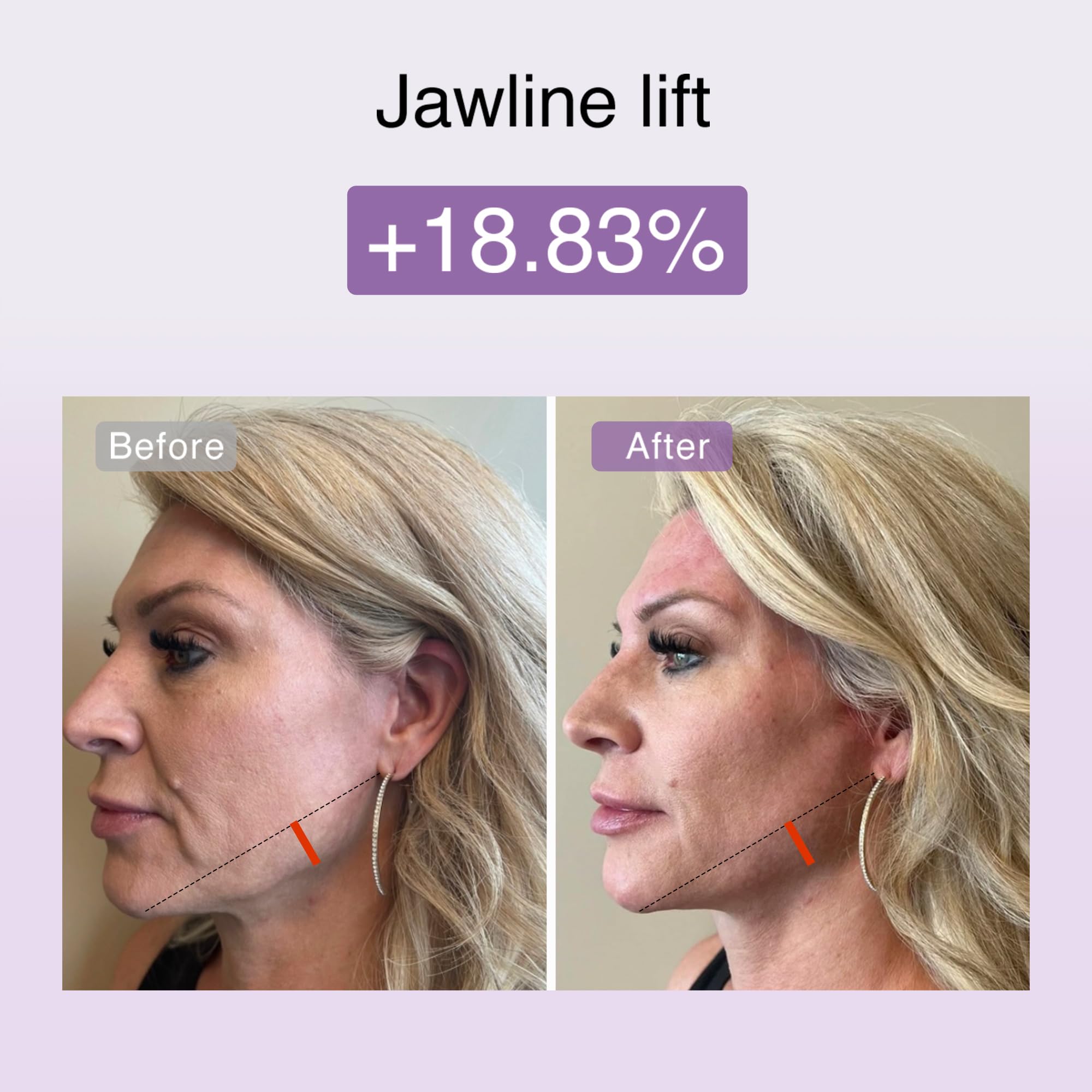 4-in-1 Microcurrent Facial Toning Device with Red Light Therapy