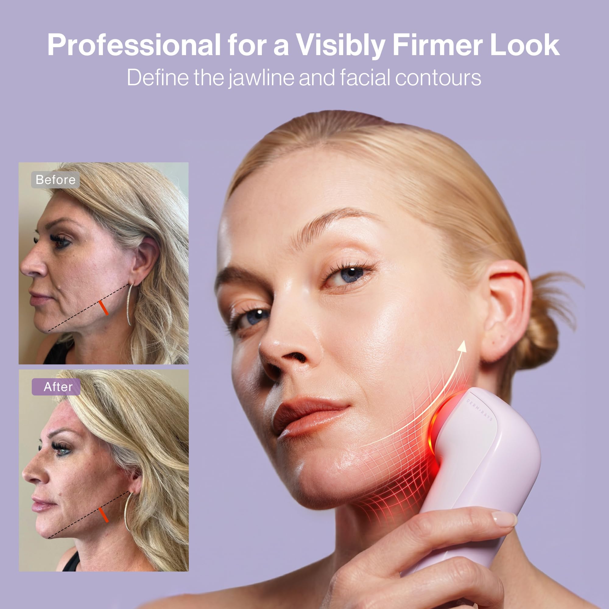 4-in-1 Microcurrent Facial Toning Device with Red Light Therapy