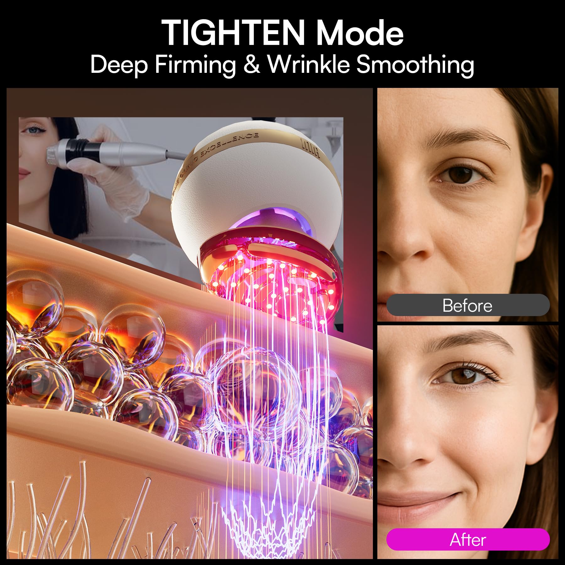 INIA SPHERA Upgraded 8-in-1 Microcurrent Facial Device for Face & Neck