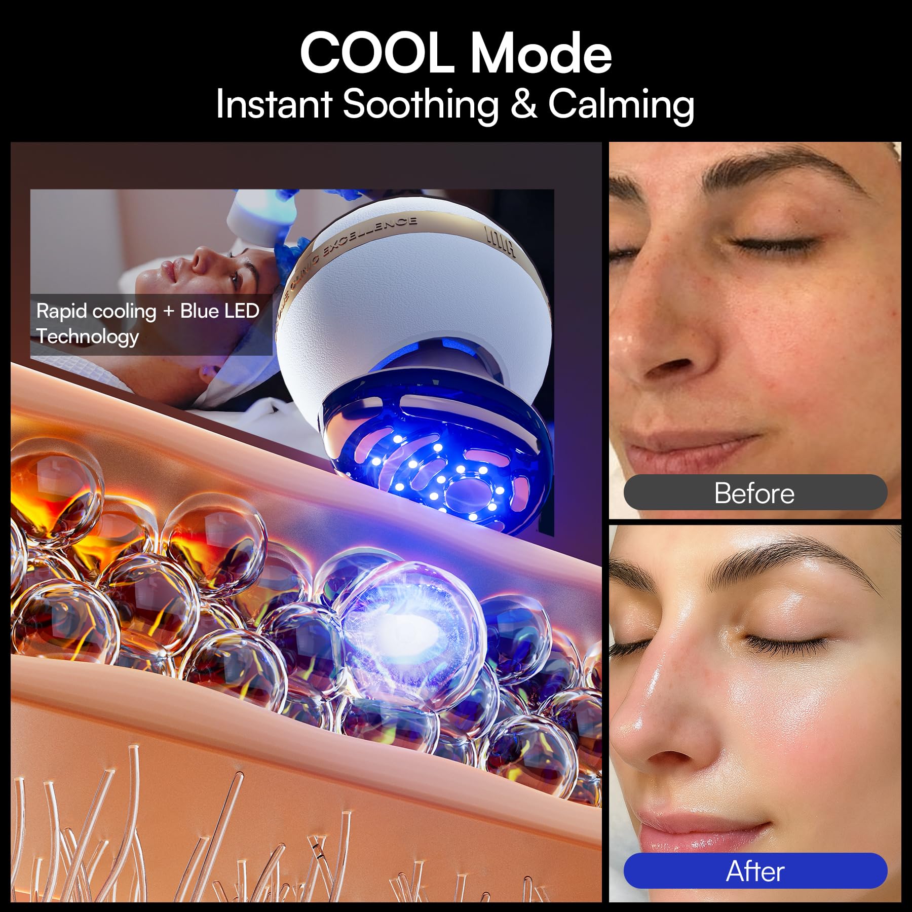 INIA SPHERA Upgraded 8-in-1 Microcurrent Facial Device for Face & Neck