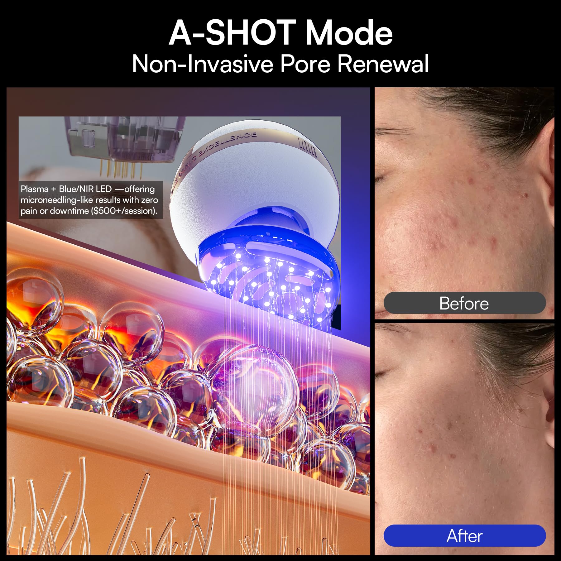 INIA SPHERA Upgraded 8-in-1 Microcurrent Facial Device for Face & Neck